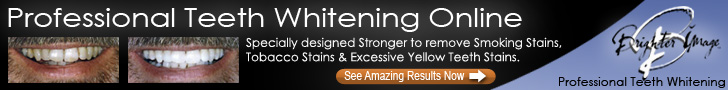 Teeth Whitening by Brighter Image Lab