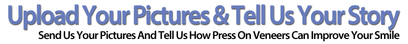 Press On Veneers Consult Title 2
