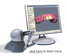 Press On Veneers 3D Design with 4X Contouring