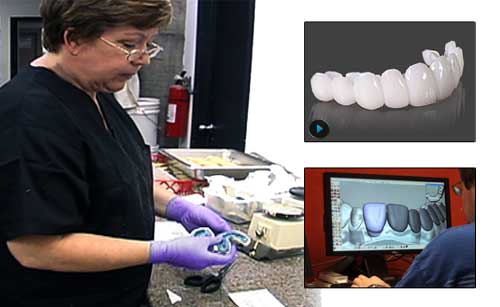 Now you can afford a new Press On Veneers