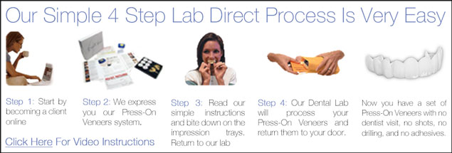 Lab Direct Press On Veneers