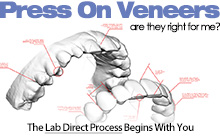 Press On Veneers Tech Drawing