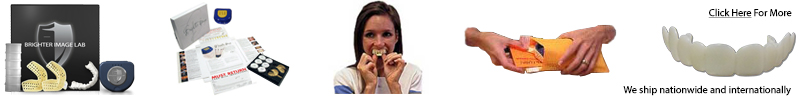 Press On Veneers Process
