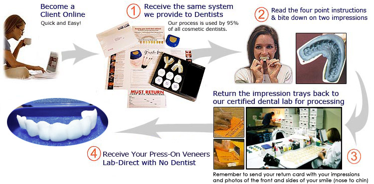 Our Simple Four Step Press On Veneers Process Is Easy