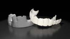 Press On Veneers Mould